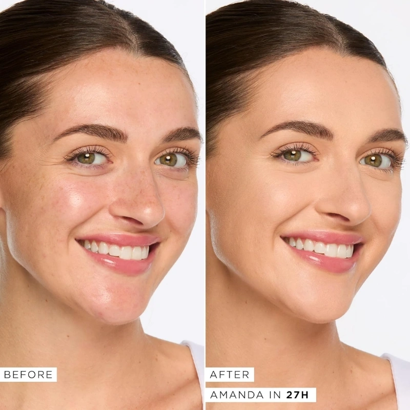 Tarte Shape Tape Full Coverage Concealer 27H Light Medium Honey | Matte, 16-Hour Wear | Best Concealer for Dry Skin & Highlights - Image 3